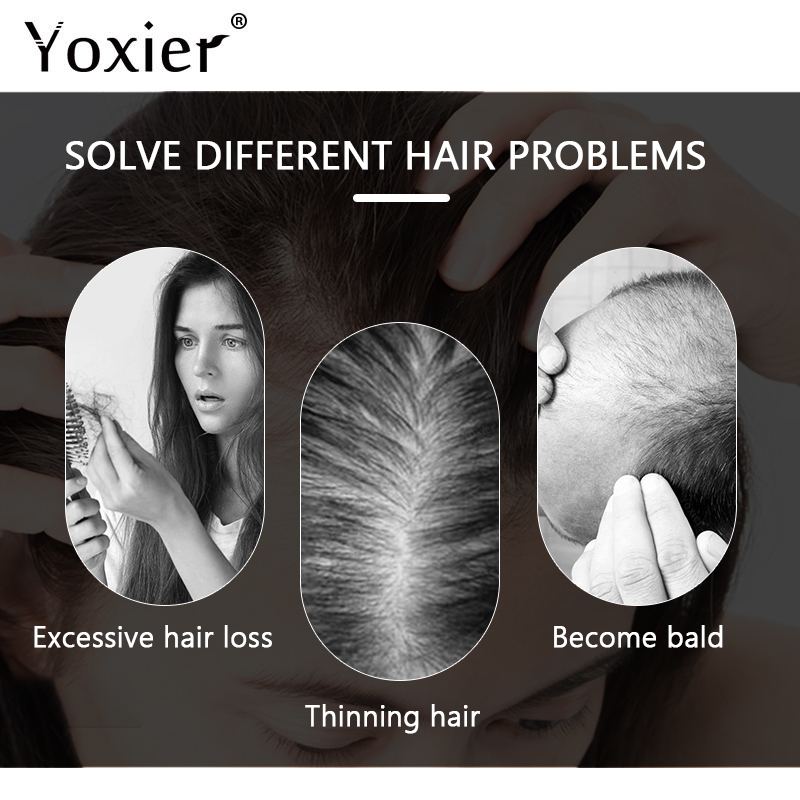 Intensywne Serum wzrostu zapob – Hair Care For Hair Loss recenzja i cena