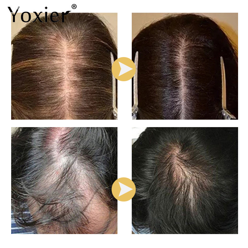 Intensywne Serum wzrostu zapob – Hair Care For Hair Loss recenzja i cena