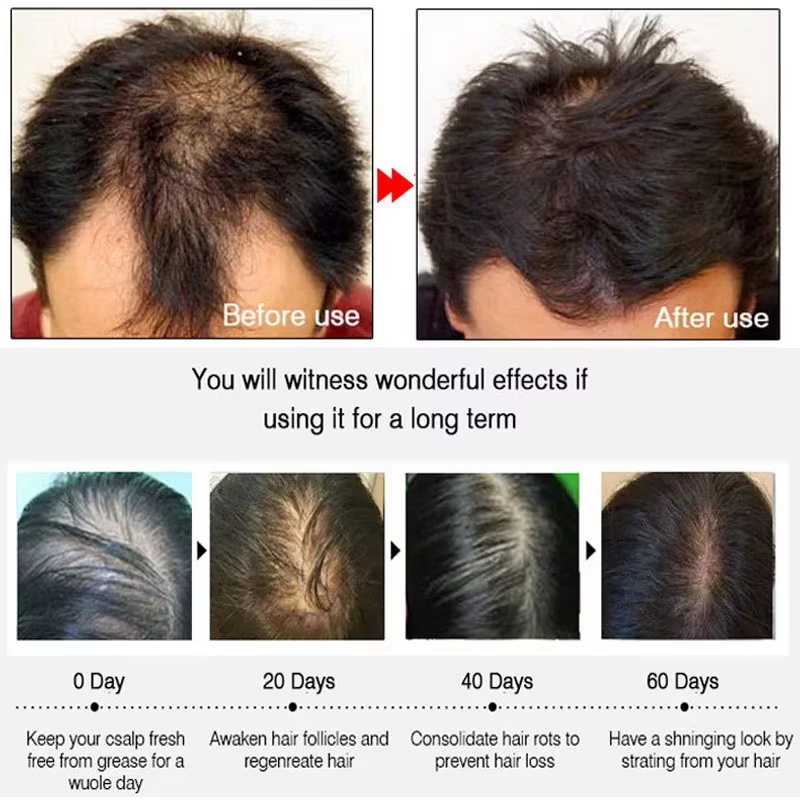 Szybki Spray na Porost Włosów  – Hair Care For Hair Loss recenzja i cena