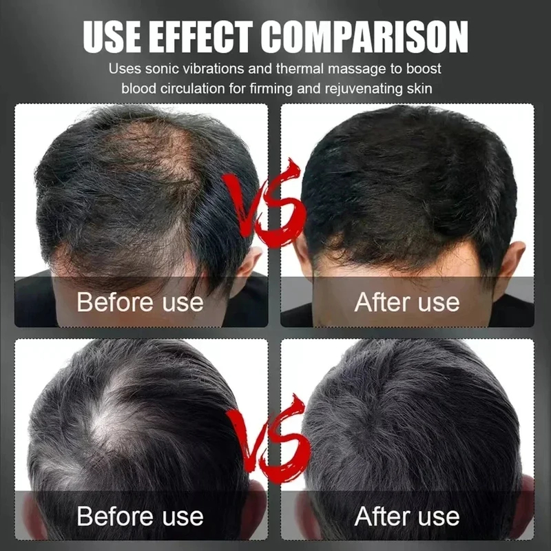 Czapka do terapii włosów czerw – Hair Care For Hair Loss recenzja i cena